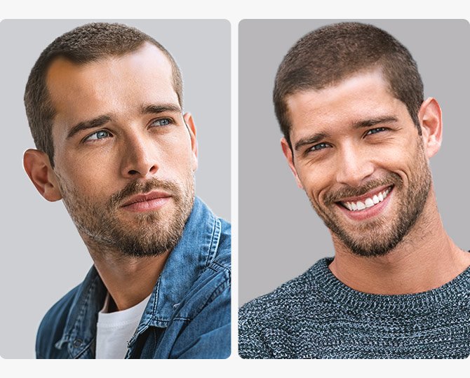 PRP Therapie Haartransplantation