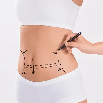 Mini Tummy Tuc
