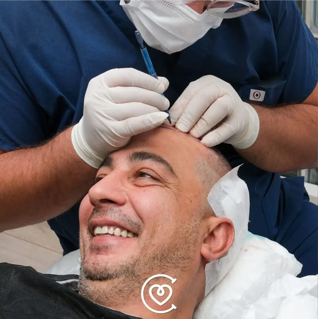 Haartransplantation
