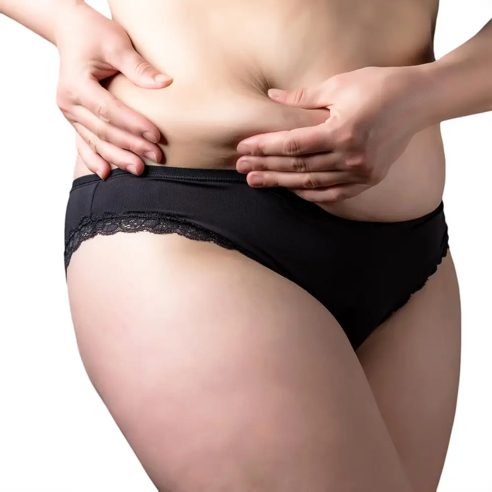 Bauchdeckenliposuktion