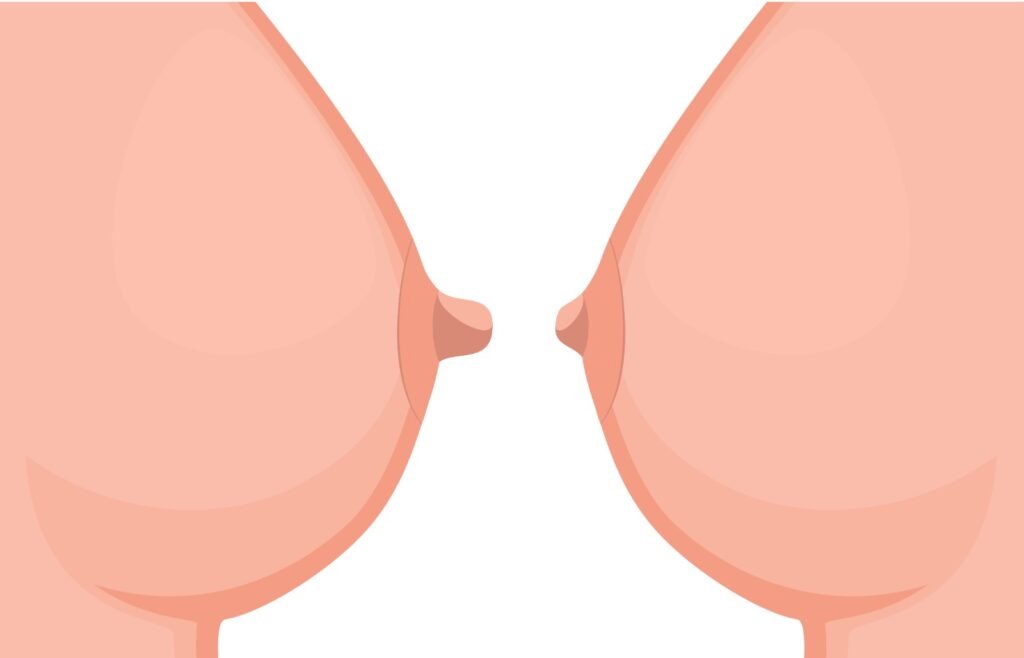 Brustwarzenverkleinerung Chirurgie