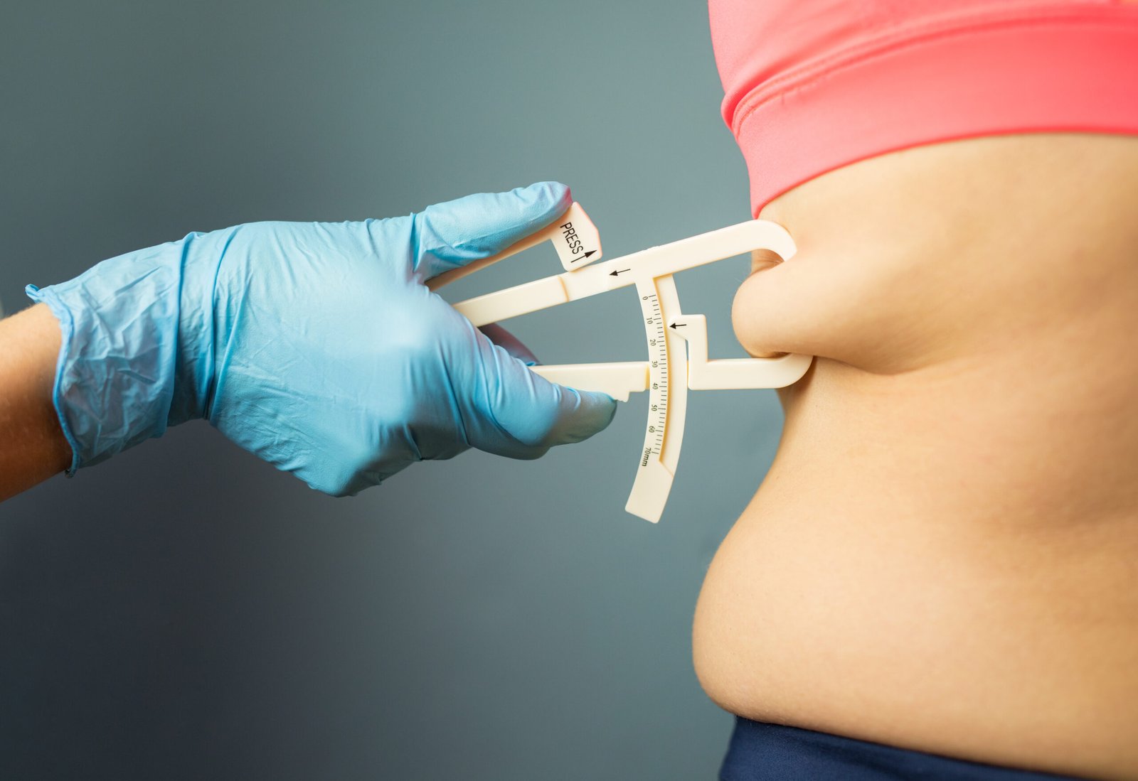 Liposuktion bei HIV-Patienten