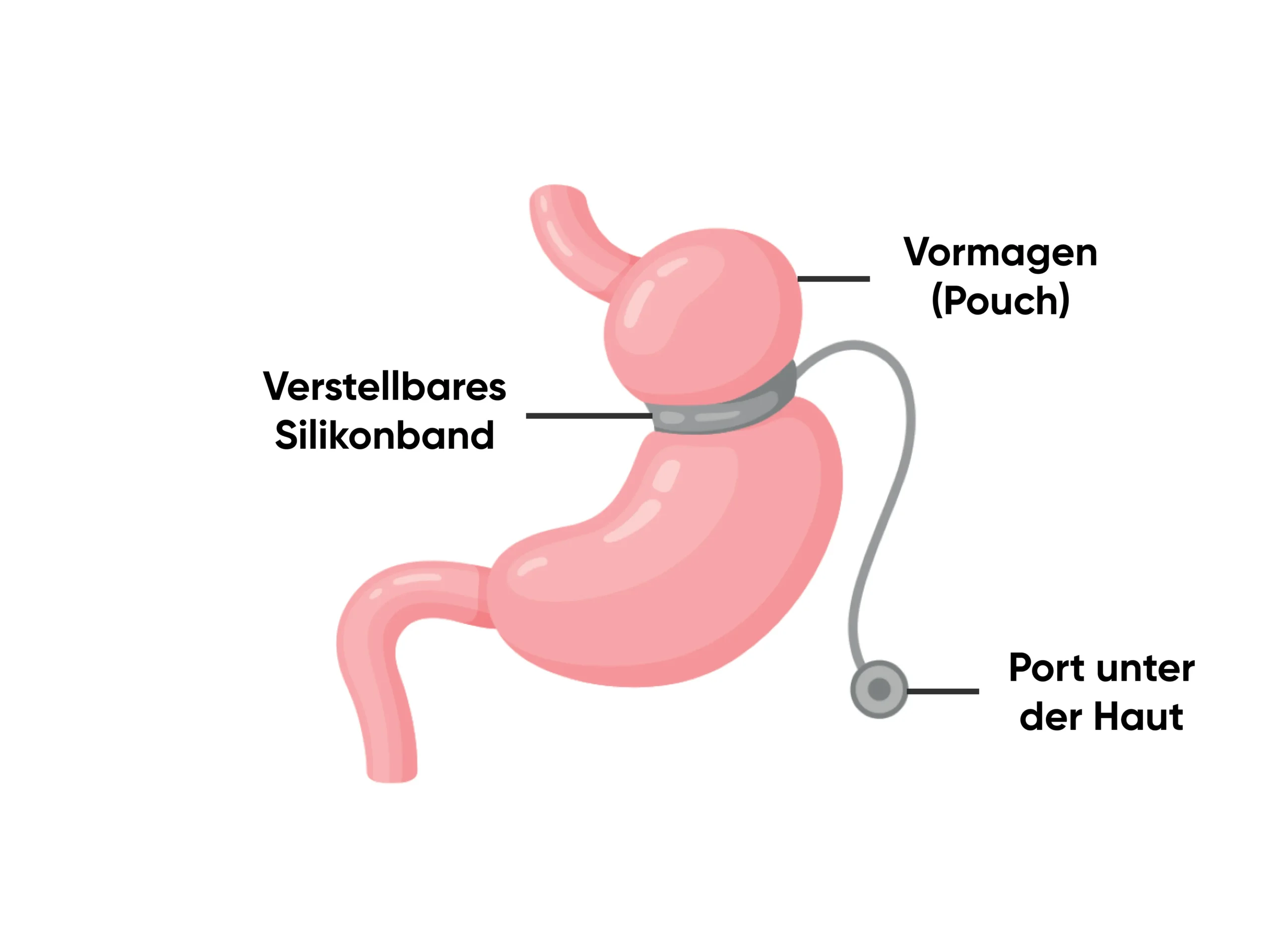 Magenband