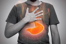 Reflux nach dem Magenbypass